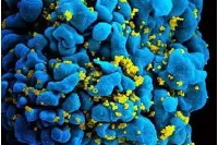 Nature：新方法可精确测量潜伏性HIV病毒库大小，比现有方法准确10到100倍